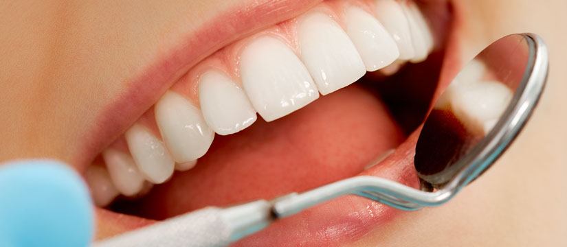 Igiene-dentale1